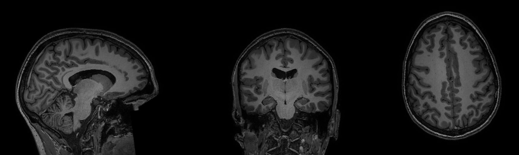 brain